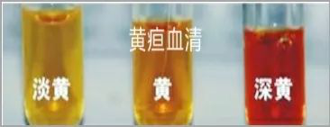 1608533986818235.png