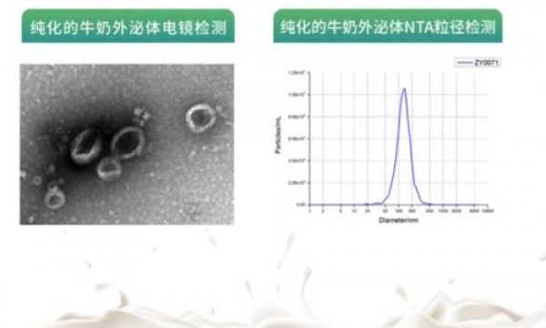 sws乳液的外泌体提取方法及要点分享