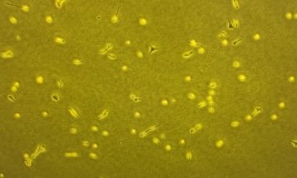 细胞培养液为什么会变黄？ 存在污染？舍为斯生物来帮你~